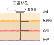 スーパー温熱